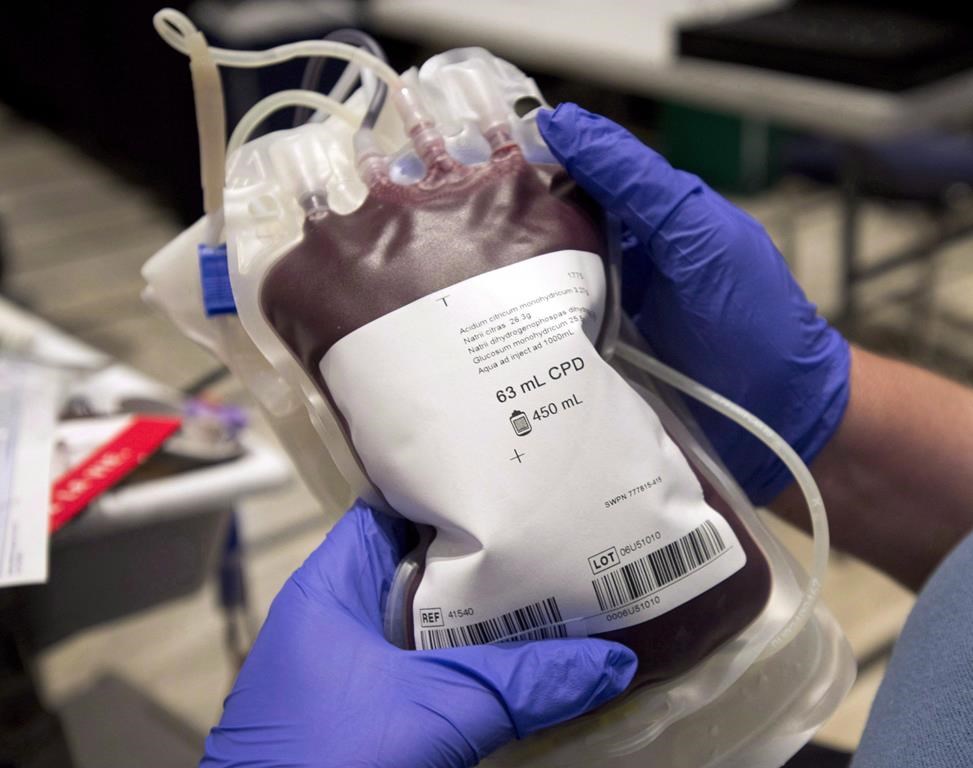 Appel d’Héma-Québec aux dons de sang car les réserves sont basses actuellement