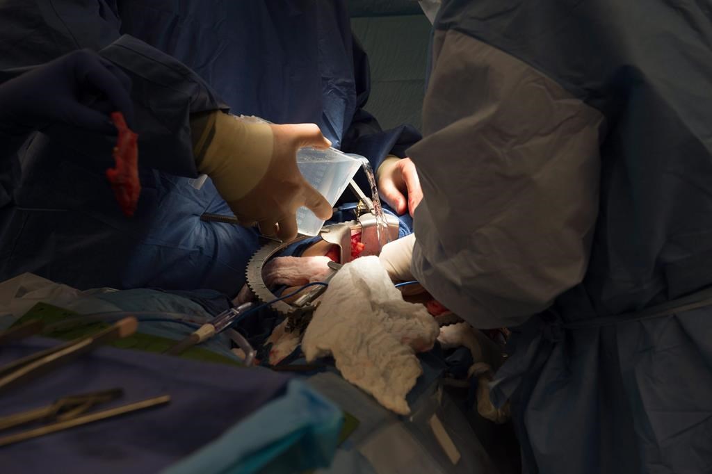 Le nombre de dons d’organes en contexte d’aide médicale à mourir en hausse au Québec