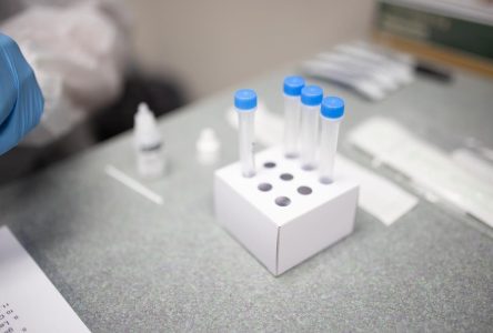 Délais chez Optilab: l’APTS réclame une décentralisation des laboratoires