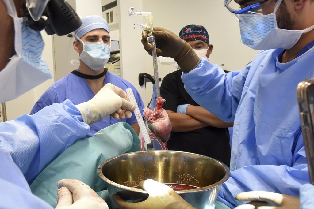 Donaciones de órganos: Transplant Québec quiere un proyecto de ley para que haya más