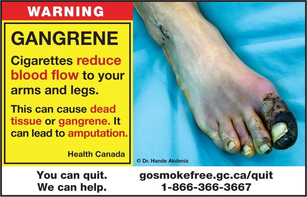 De nouvelles images chocs sur les paquets de cigarettes au Canada