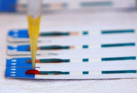 VIH: fin le mois prochain du financement fédéral des tests à domicile