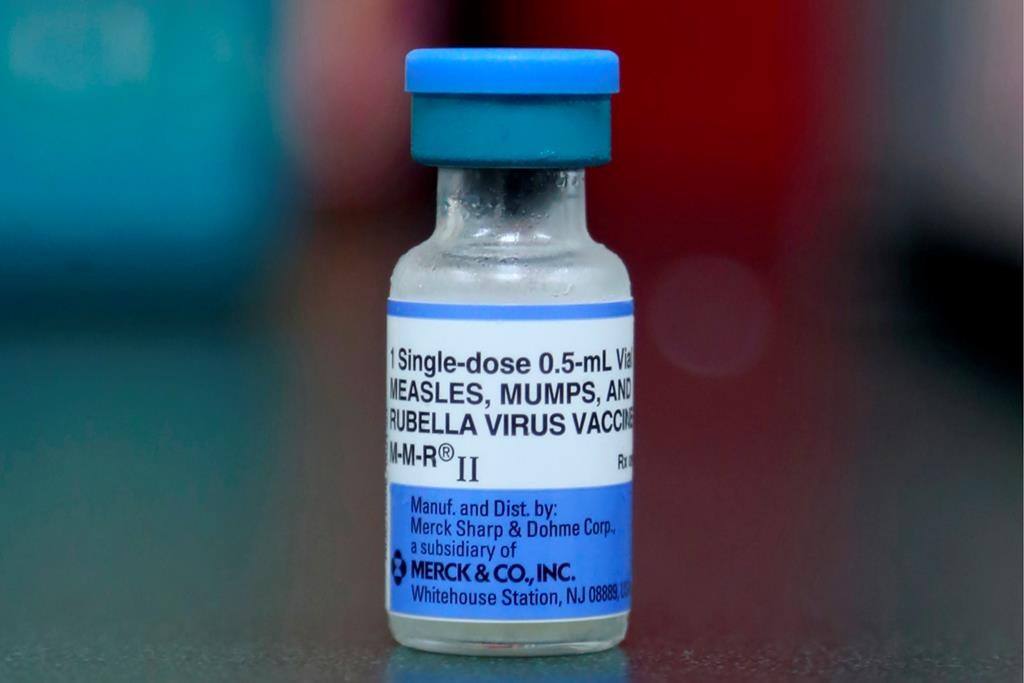 La santé publique insiste sur la vaccination contre la rougeole, en recrudescence