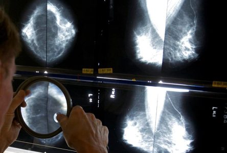 Cancer du sein: dépistage gratuit désormais élargi aux Québécoises de 70 à 74 ans