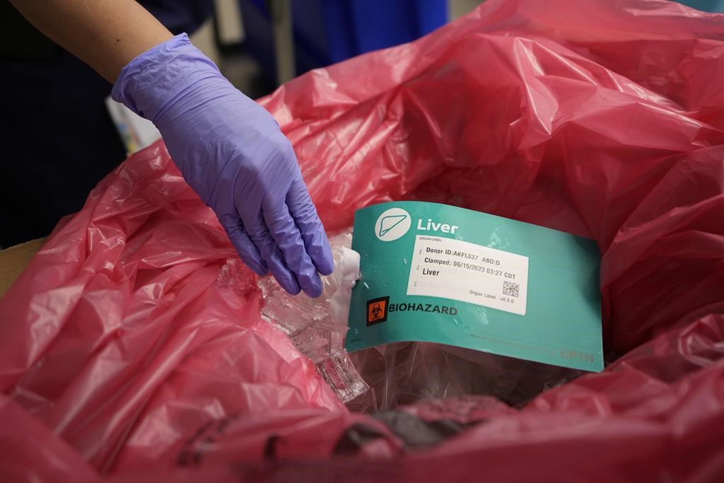 Près de 80 % des Québécois veulent une loi sur le don d’organes